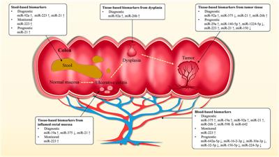 miRNA-Based Potential Biomarkers and New Molecular Insights in Ulcerative Colitis